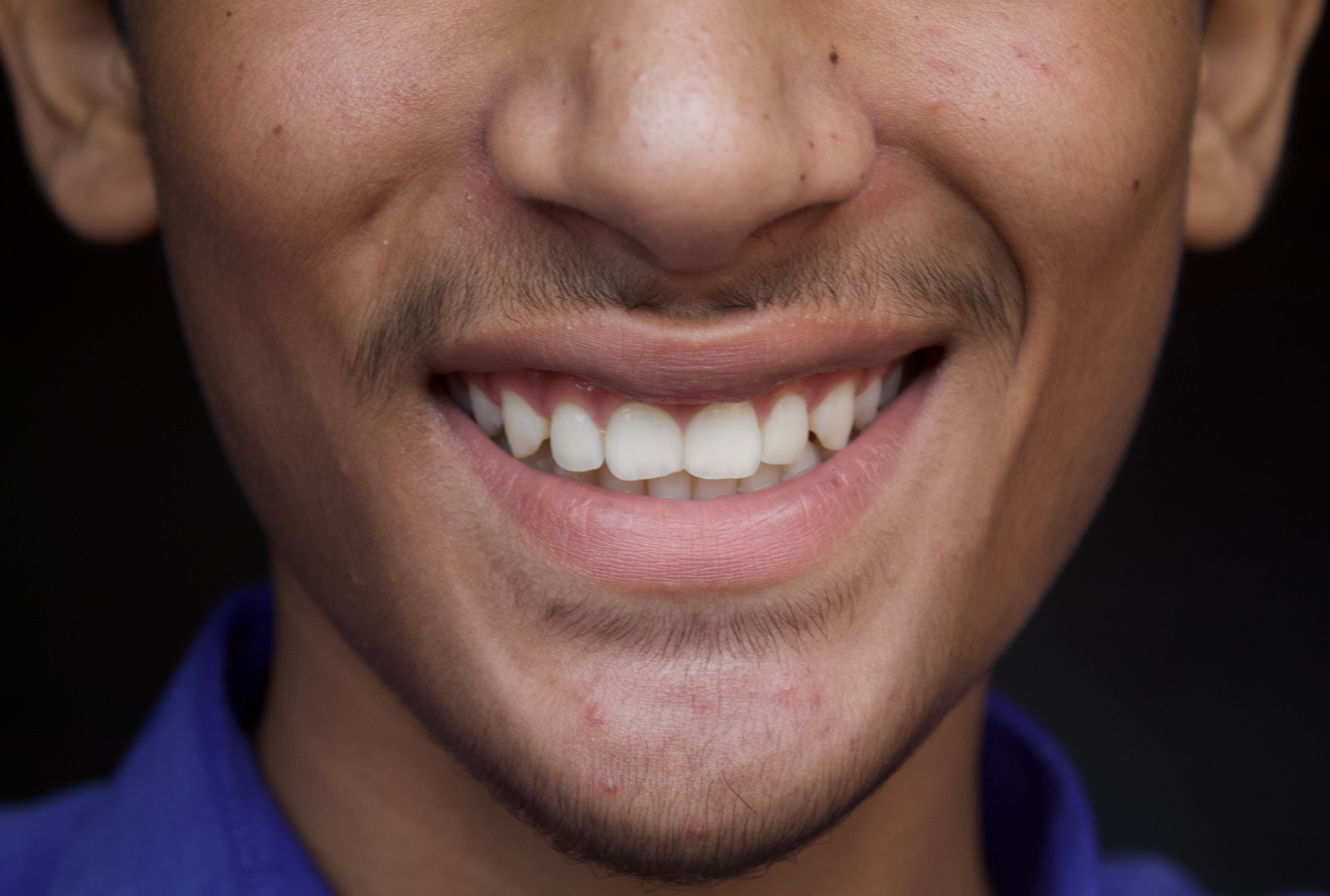 Close-up of a young man's healthy smile showing strong white teeth