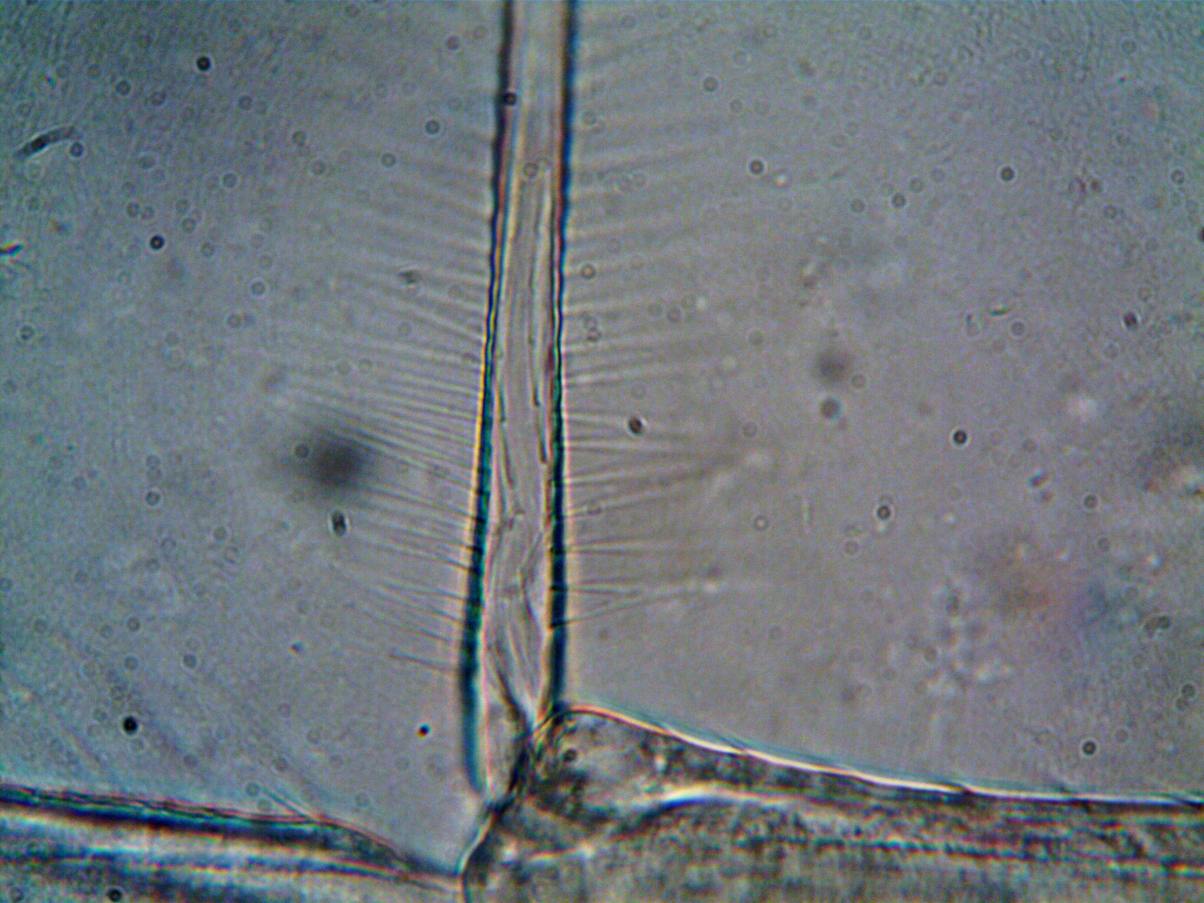 Magnified view of microorganisms under a microscope representing systemic inflammation